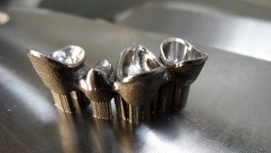 Fogkorona, implantátum, orvostechnika, fogtechnika - MetalPrinting - 3D fémnyomtatás